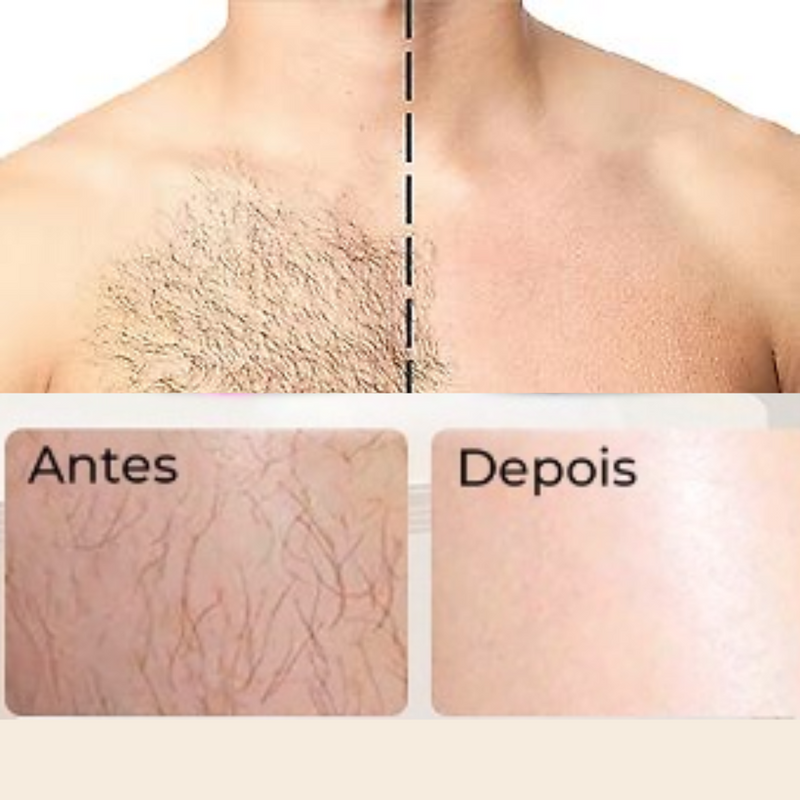 Depilador de Cristal Nano Tecnologia